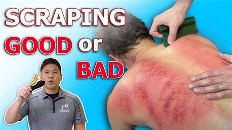 physical therapy muscle scraper|Muscle Scraping: Before & After (Graston Technique) .